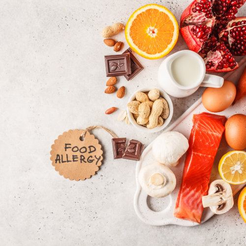ALLERGIES ALIMENTAIRES : GENERALITES